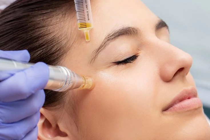Does PRP Treatment Improve Healing Skin