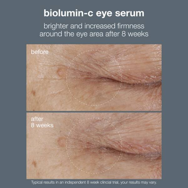 biolumin c eye serum ba